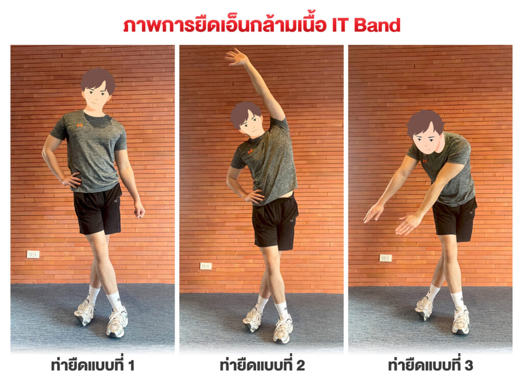 IT band syndrome